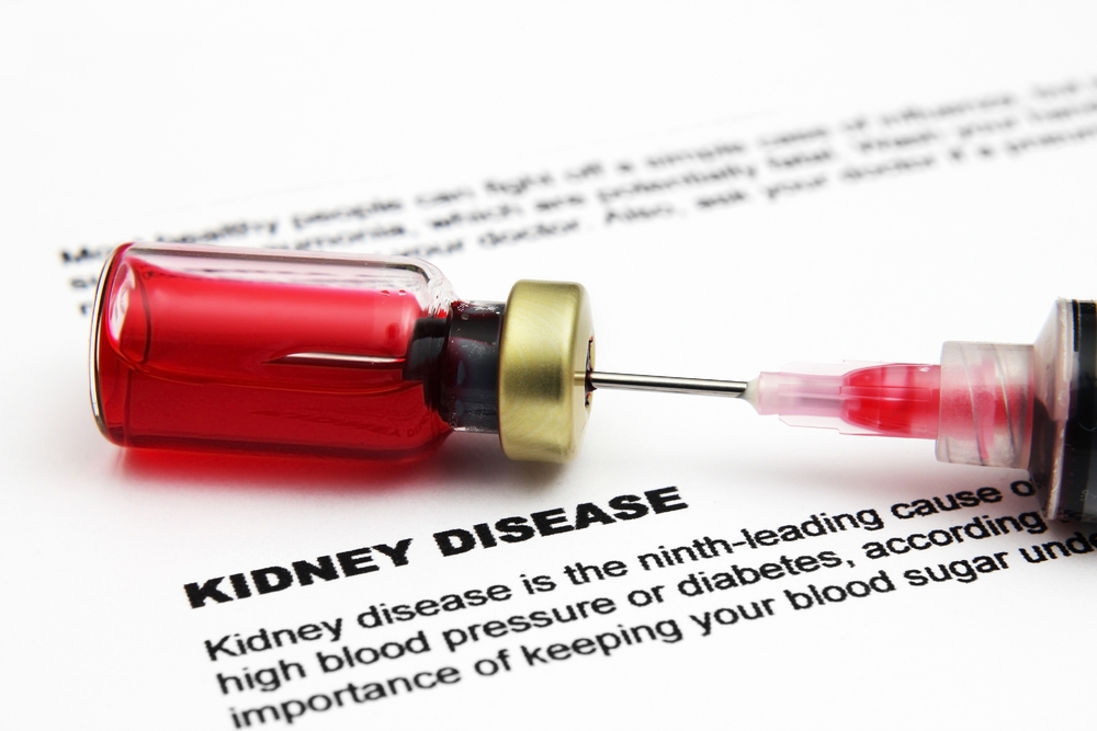 kidney disease due to scleroderma