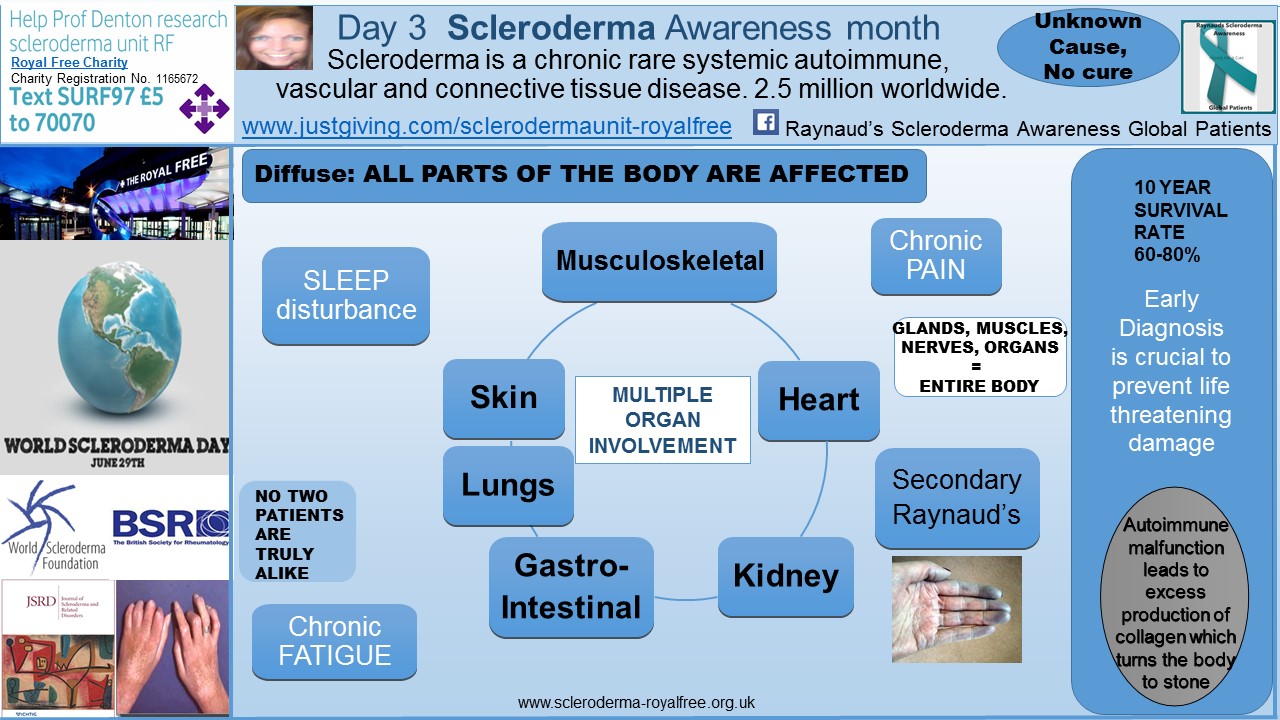 Day 3 Scleroderma Awareness month