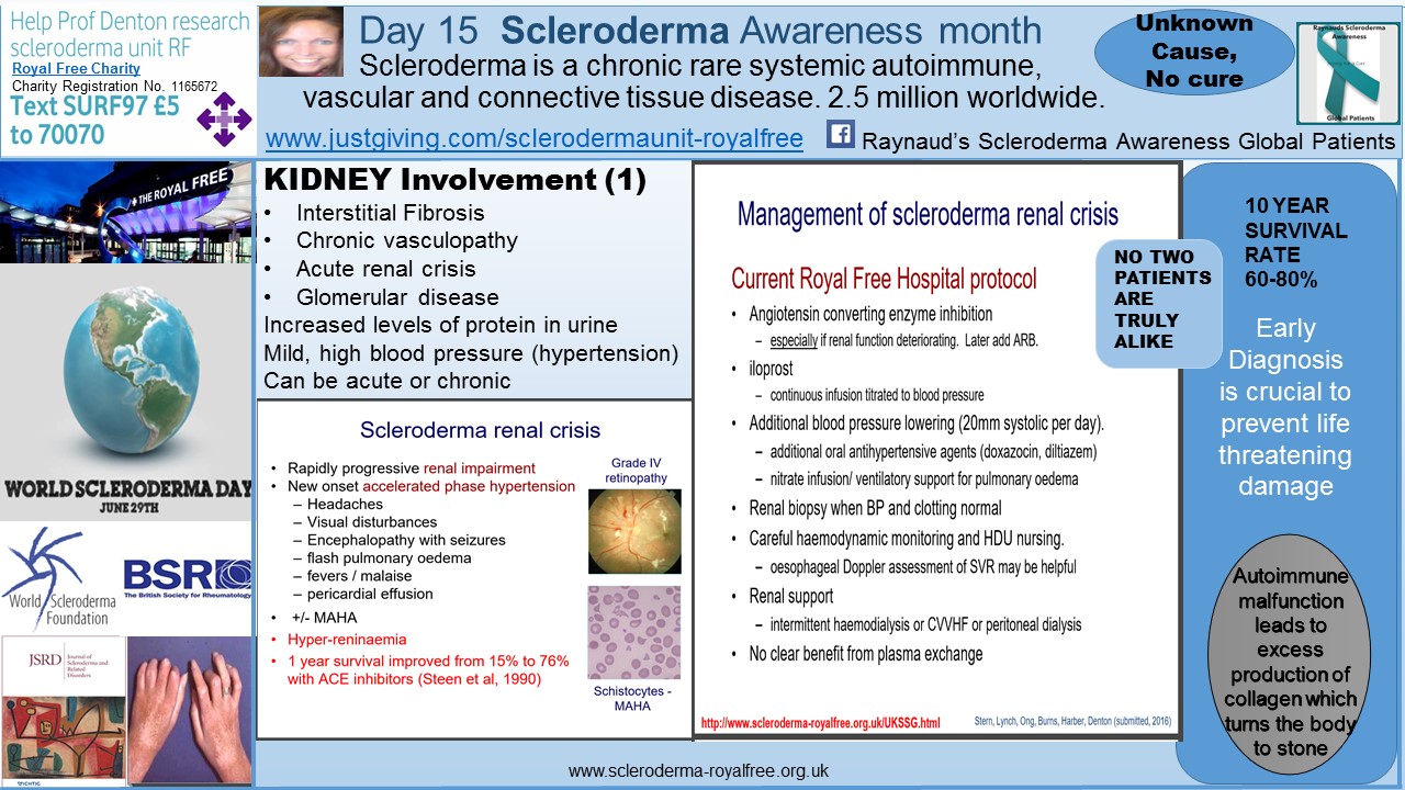 Day 15 Scleroderma Awareness month