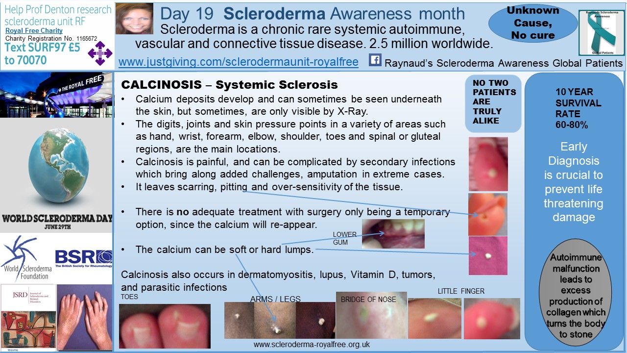 Day 19 Scleroderma Awareness month