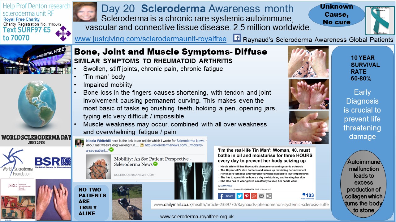 Day 20 Scleroderma Awareness month