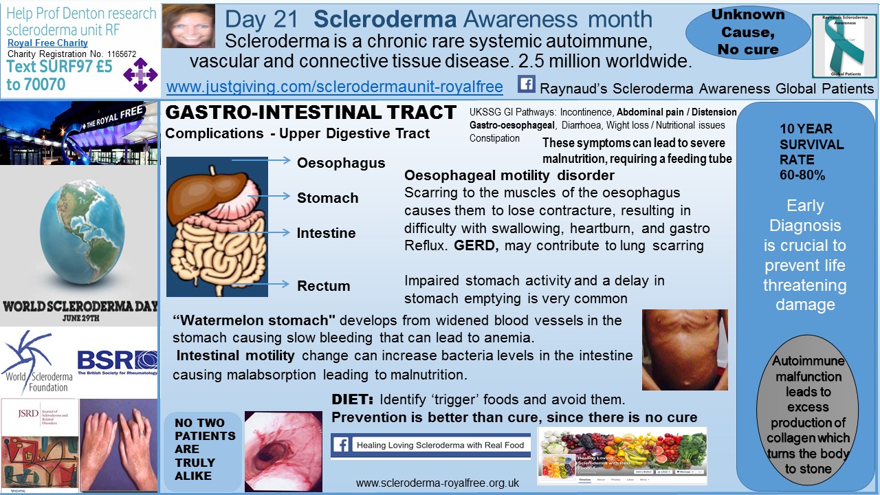 Day 21 Scleroderma Awareness month