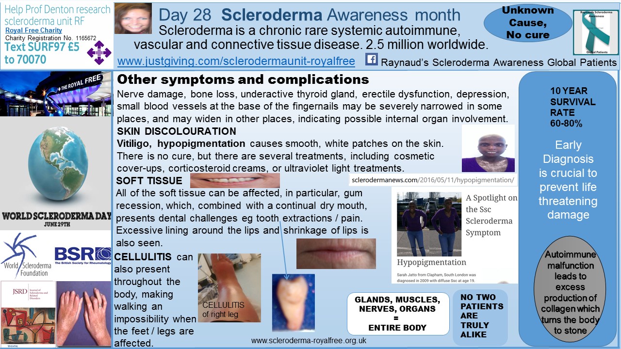 Day 28 Scleroderma Awareness month