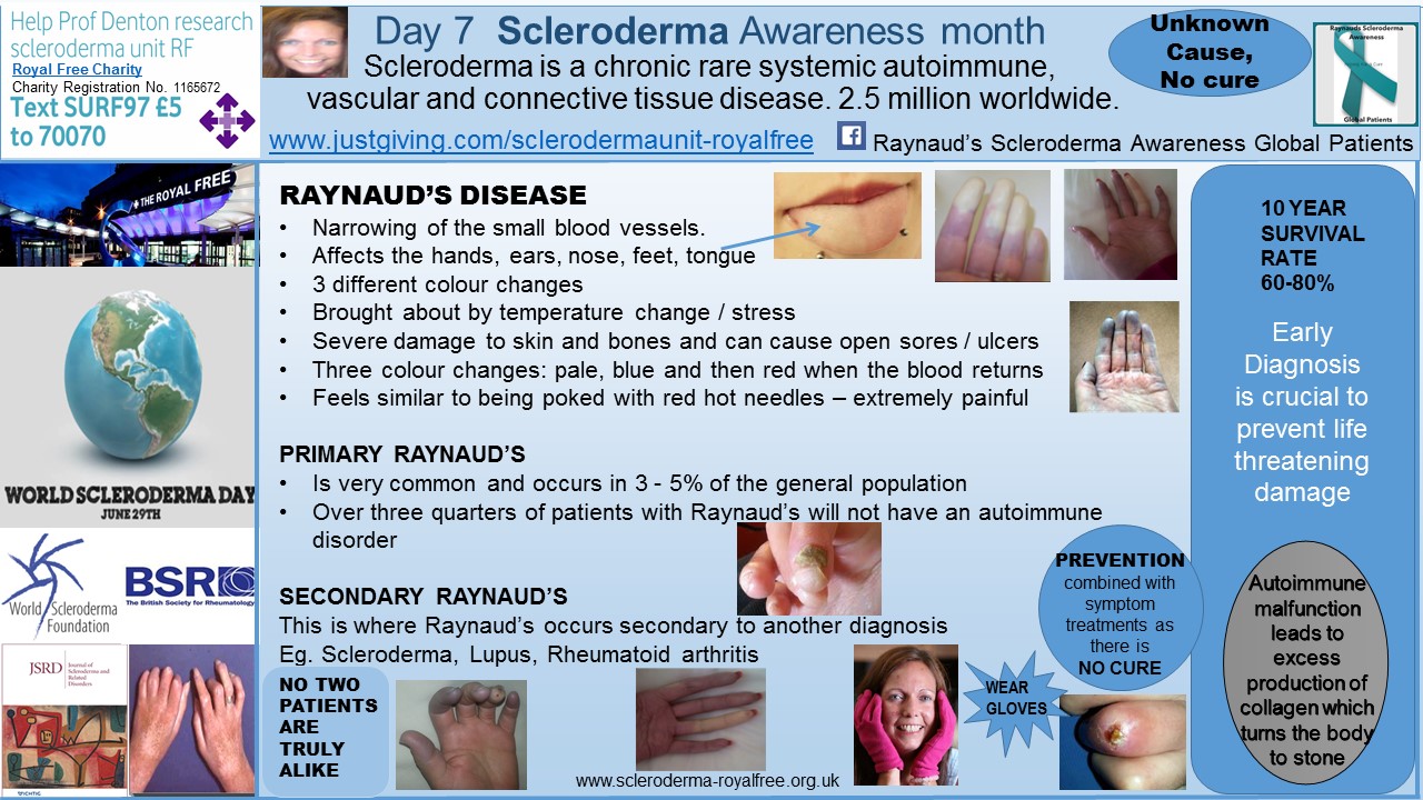 Day 7 Scleroderma Awareness month