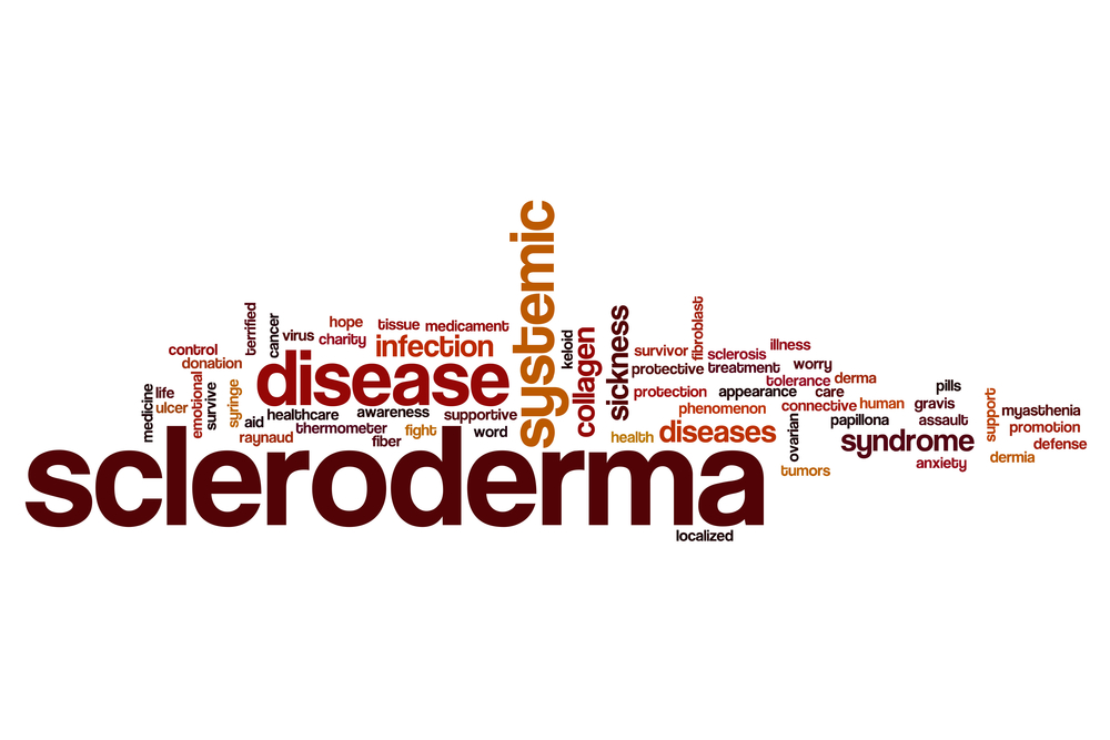 scleroderma