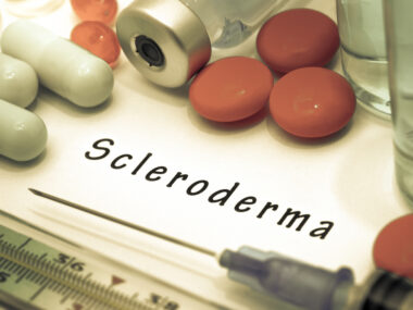 stronger, scleroderma symptoms
