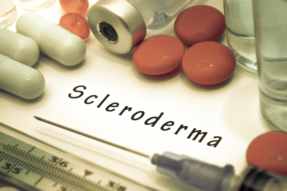stronger, scleroderma symptoms