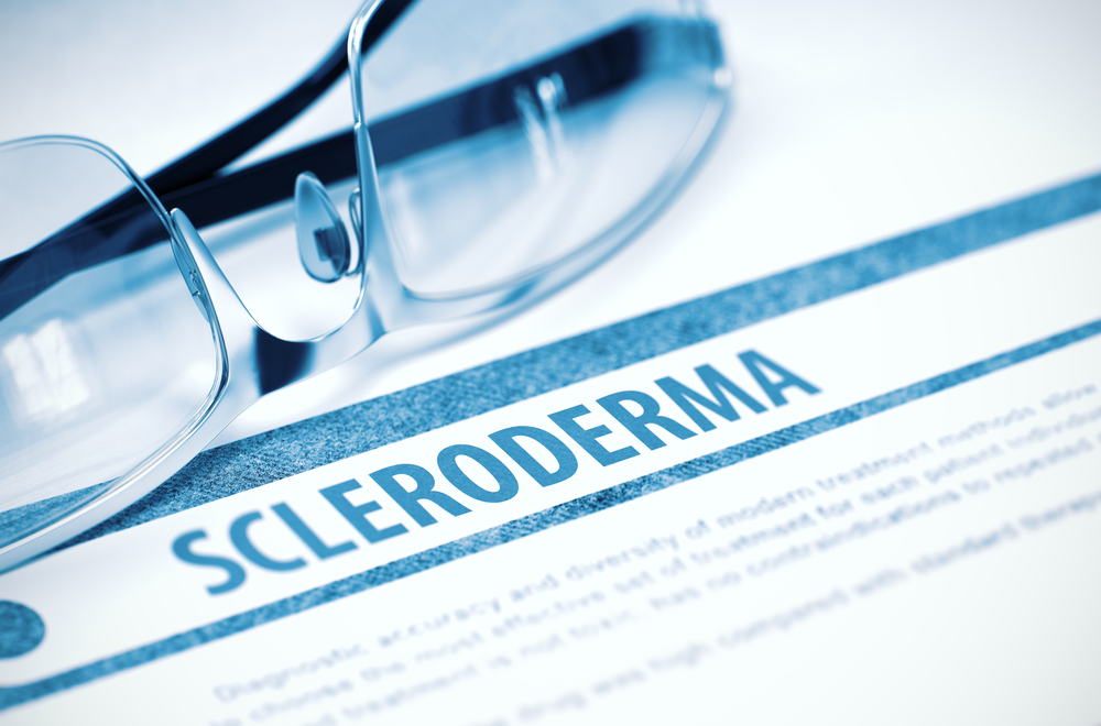 scleroderma pain