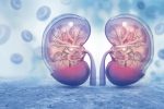 kidney transplant for ESRD