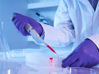blood tests and disease progression