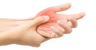 peripheral nerve damage/sclerodermanews.com/peripheral neuropathy within 10 years