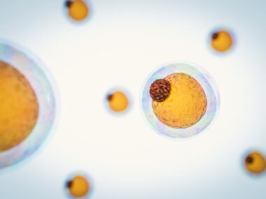 Cytori's hand function therapy