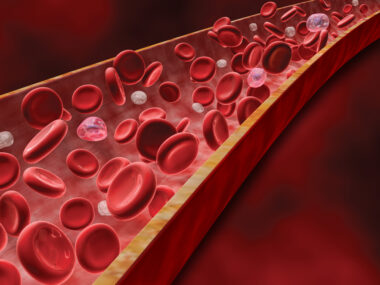 CX3CL1 in scleroderma