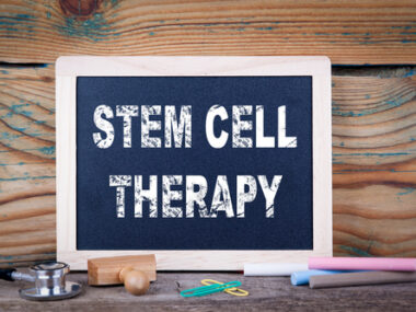 stem cell transplant