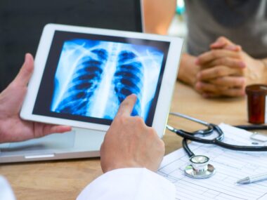 lenabasum lung function