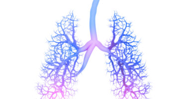 scleroderma and PAH