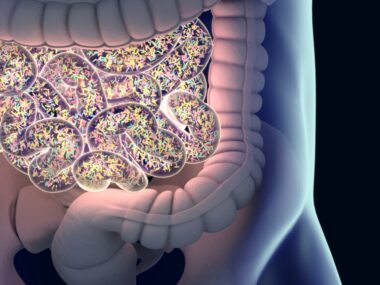 bowel perforation