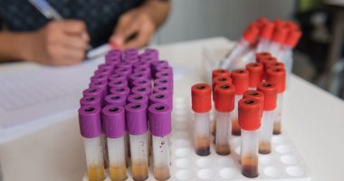 COVID-19 vaccines | Scleroderma News | Vials of blood on display in laboratory