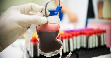 stem cell transplant study
