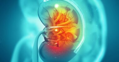 corticosteroids and the kidneys