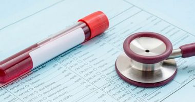 FLC levels in urine and blood