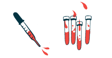 SIRT1 and SIRT3 | Scleroderma News | illustration of vials and syringe of blood