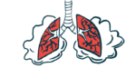 SSc-ILD | Scleroderma News | illustration of the lungs