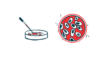 CAN10 | Scleroderma News | illustration of petri dish