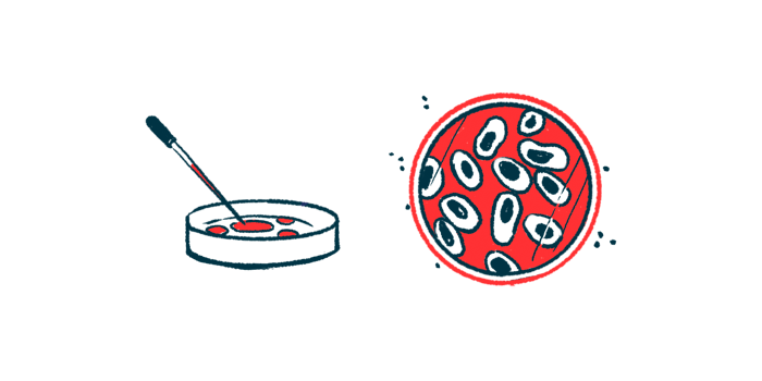 gene profiling | Scleroderma News | illustration of petri dish