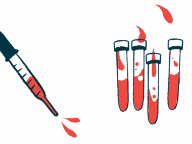 An illustration of vials and a dropper with blood.