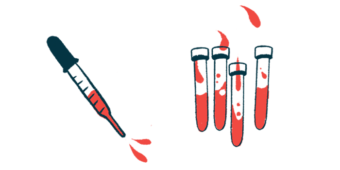 An illustration of vials and a dropper with blood.