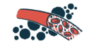 An illustration of a blood vessel, focusing on the lumen, the hollow tube through which blood flows.