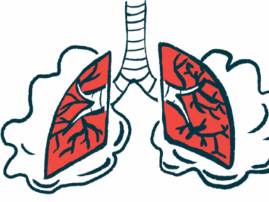 An illustration shows a close-up representation of damaged human lungs.