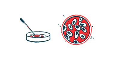 A petri dish is shown from two different points of view.