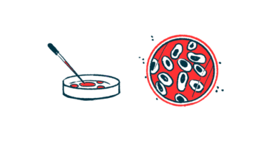 A petri dish is shown from two different points of view.