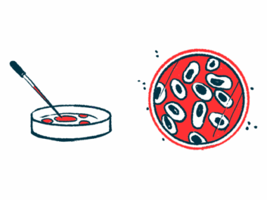 A petri dish is shown from two different points of view.