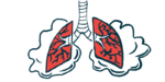 A set of lungs are shown laboring to breathe.
