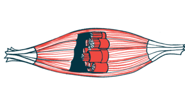 A close-up illustration of a human muscle has a cut-out to show its inside construction.