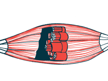 A close-up illustration of a human muscle has a cut-out to show its inside construction.