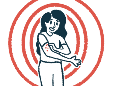 A person uses one hand to touch scaly patches on the other upper arm.