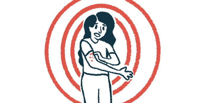 A person uses one hand to touch scaly patches on the other upper arm.